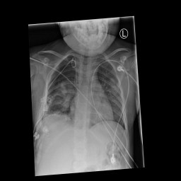 1.2.276.0.7230010.3.1.4.8323329.2345.1517875172.290155